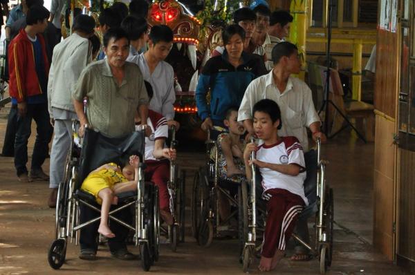 bại não - khuyết tật - Hình mô tả 1