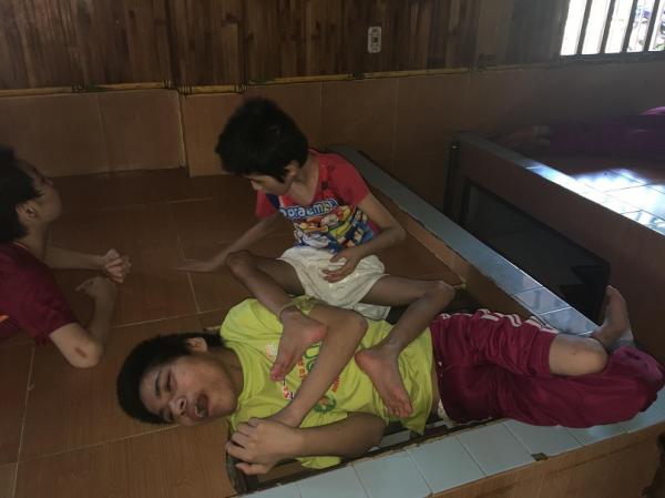 bại não - khuyết tật - Hình mô tả 14