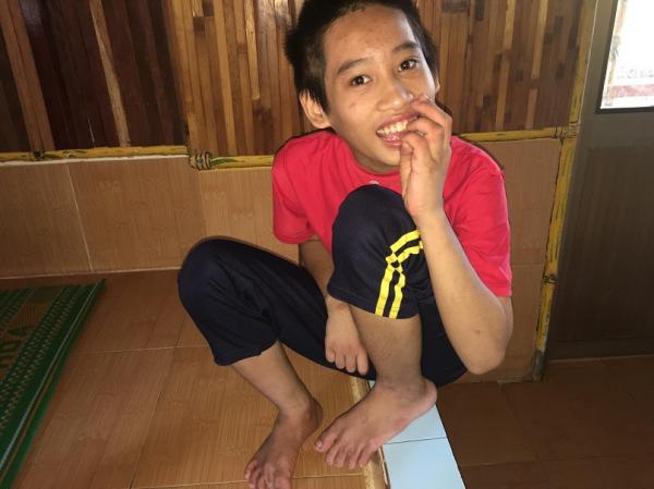 bại não - khuyết tật - Hình mô tả 4