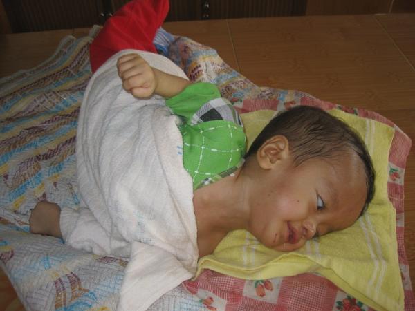 Các em bại não - Hình mô tả 15