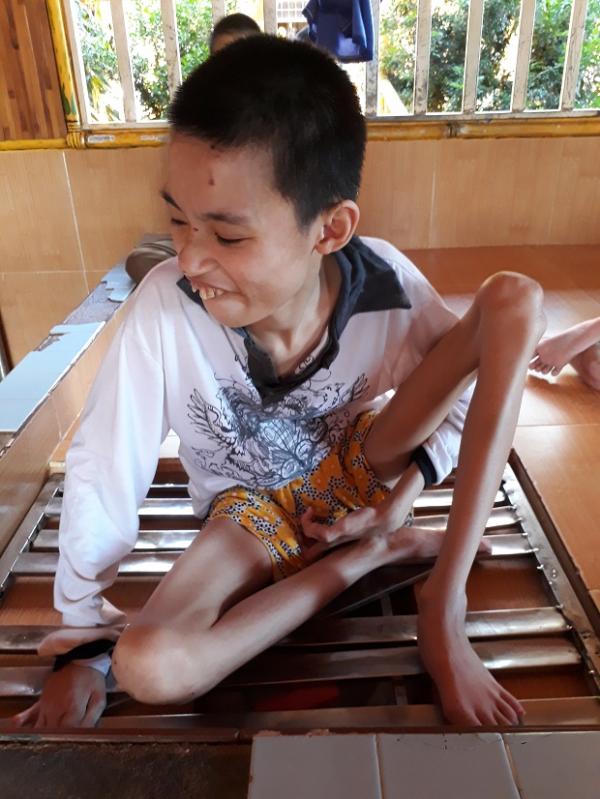 Các em bại não - Hình mô tả 7