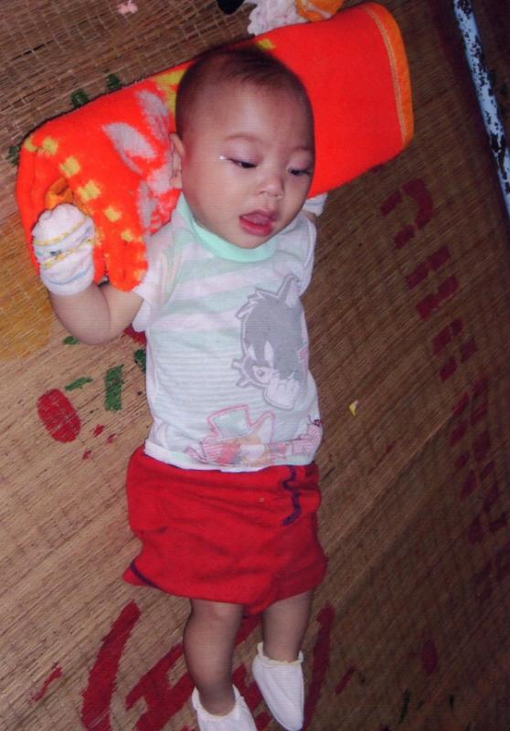 Các em bại não - Hình mô tả 17